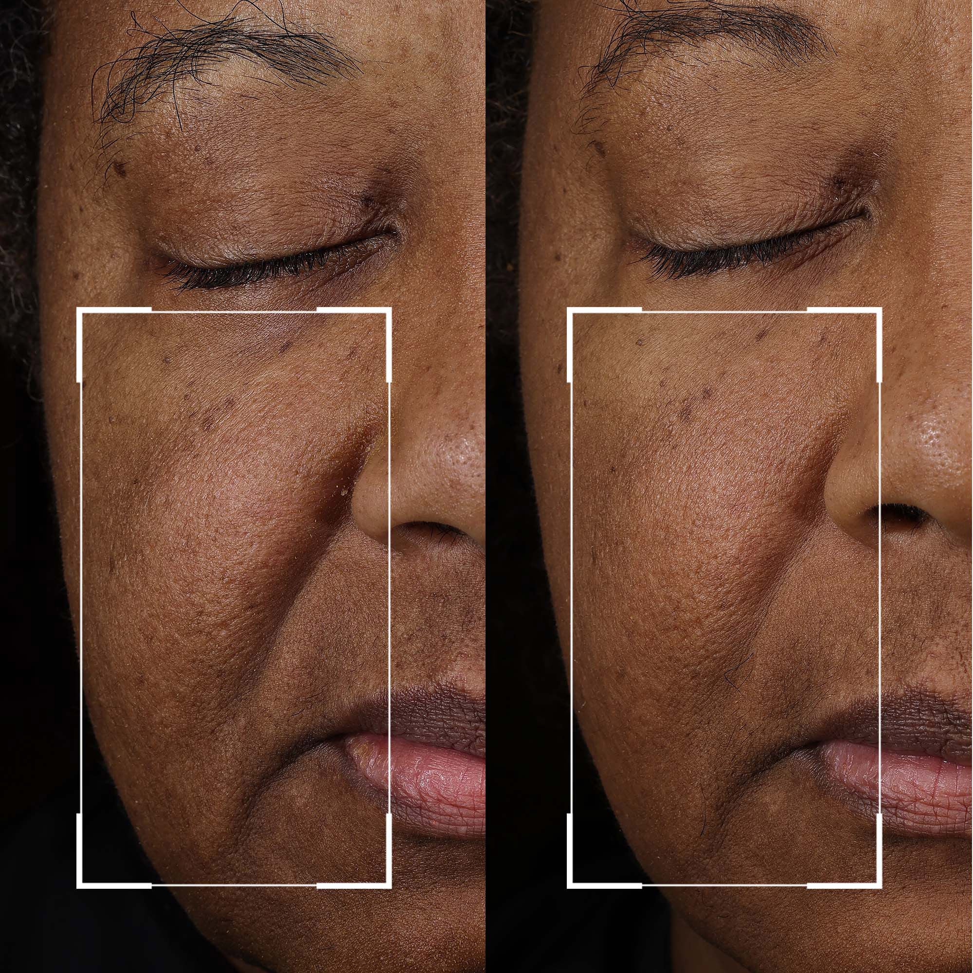 Strivectin Peptight Face Lift Serum